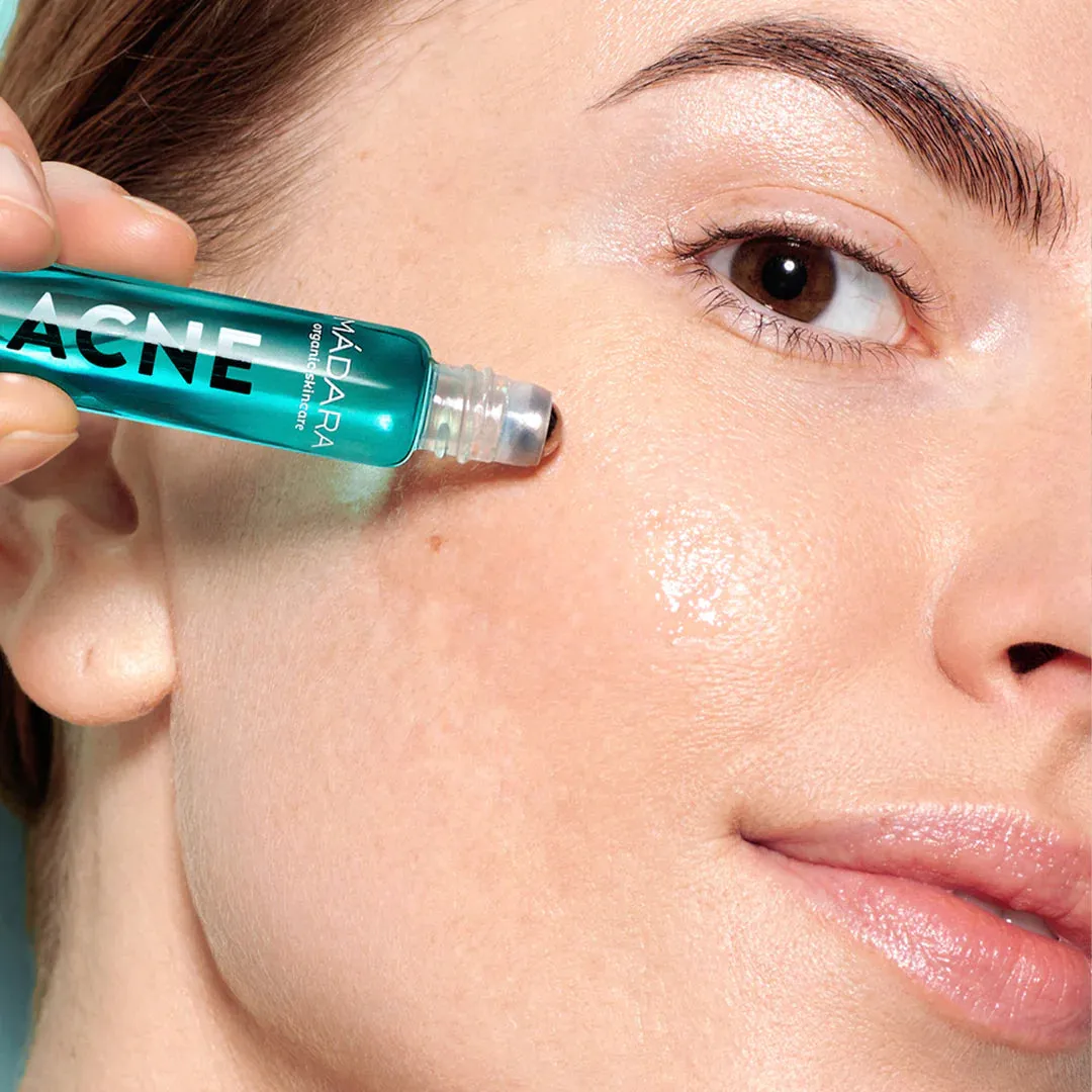 Acute Spot Roll-On 'ACNE'